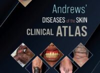 Andrews Diseases of the Skin Clinical Atlas